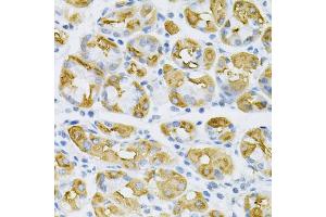 Immunohistochemistry of paraffin-embedded human stomach using SDC4 Antibody (ABIN5970935) at dilution of 1/100 (40x lens). (SDC4 antibody)