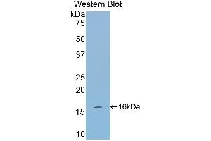 Western Blotting (WB) image for anti-Tryptase alpha/beta 1 (TPSAB1) (AA 149-273) antibody (ABIN1174174) (TPSAB1 antibody  (AA 149-273))