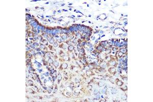 Immunohistochemistry of paraffin-embedded human esophageal using  Rabbit mAb (ABIN7265589) at dilution of 1:100 (40x lens). (Angiopoietin 2 antibody)