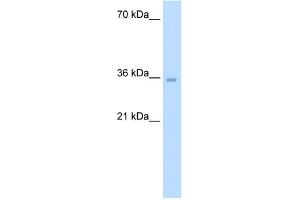 ATIC antibody - middle region  validated by WB using Jurkat cell lysate at 5. (ATIC antibody  (Middle Region))