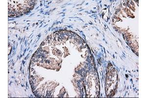 Immunohistochemical staining of paraffin-embedded Human liver tissue using anti-TBXAS1 mouse monoclonal antibody.