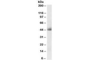 Western blot testing of human kidney lysate with CA12 antibody at 0. (CA12 antibody)