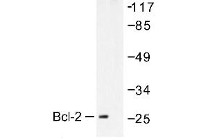 Image no. 1 for anti-B-Cell CLL/lymphoma 2 (BCL2) antibody (ABIN271996) (Bcl-2 antibody)