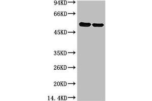 Western blot analysis of Arabidopsis with Rubisco(Large Chain) Mouse mAb diluted at 1)1:2,000,2)1:5,000 (Rubisco Large Chain antibody)