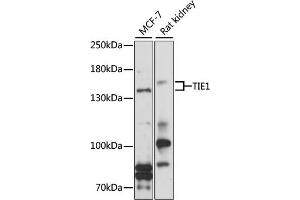 Western blot analysis of extracts of various cell lines, using TIE1 antibody (ABIN1683033, ABIN3017717, ABIN3017718 and ABIN6220214) at 1:1000 dilution. (TIE1 antibody  (AA 350-600))