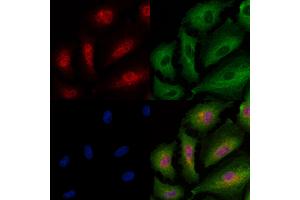 Phospho-RSK2 (Ser386) Antibody staining A549 cells(4h of LPS treatment) by IF/ICC.