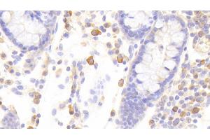 Detection of STAT1 in Human Colon Tissue using Polyclonal Antibody to Signal Transducer And Activator Of Transcription 1 (STAT1) (STAT1 antibody  (AA 343-602))