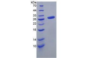 Image no. 1 for Fibroblast Growth Factor 23 (FGF23) (AA 25-251) (Active) protein (His tag) (ABIN6239859) (FGF23 Protein (AA 25-251) (His tag))