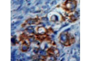 IHC-P analysis of Ovary tissue, with DAB staining. (CD70 antibody  (AA 47-191))