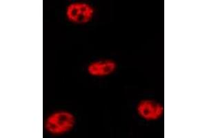 ABIN6267291 staining MDA-MB-435 by IF/ICC.