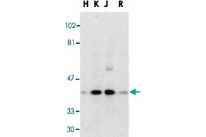 Western blot analysis of Dffb in HeLa (H), K-562 (K), Jurkat (J), and Raji (R) whole cell lysate with Dffb polyclonal antibody  at 1 : 500 dilution. (DFFB antibody  (Internal Region))