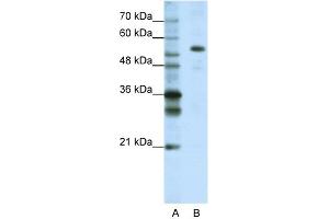 WB Suggested Anti-FLJ12529 Antibody Titration:  1. (CPSF7 antibody  (C-Term))