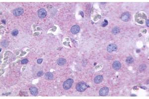 Anti-PTGFR antibody  ABIN1049262 IHC staining of human ovary. (PTGFR antibody  (Cytoplasmic Domain))