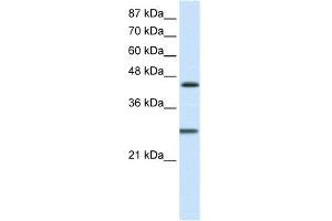 WB Suggested Anti-HES6 Antibody Titration:  1. (HES6 antibody  (C-Term))