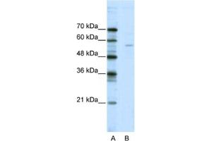 Western Blotting (WB) image for anti-ELK1, Member of ETS Oncogene Family (ELK1) antibody (ABIN2461748) (ELK1 antibody)