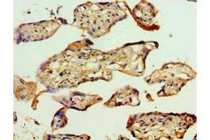 Immunohistochemistry of paraffin-embedded human placenta tissue using ABIN7142944 at dilution of 1:100 (ACAT2 antibody  (AA 1-97))