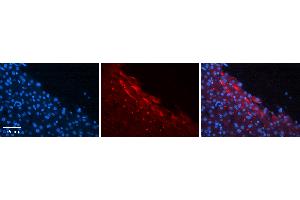 Rabbit Anti-CTAGE5 Antibody   Formalin Fixed Paraffin Embedded Tissue: Human Liver Tissue Observed Staining: Plasma membrane in hepatocytes Primary Antibody Concentration: 1:100 Other Working Concentrations: N/A Secondary Antibody: Donkey anti-Rabbit-Cy3 Secondary Antibody Concentration: 1:200 Magnification: 20X Exposure Time: 0. (MIA2 antibody  (N-Term))