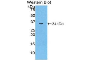 Western Blotting (WB) image for anti-Matrix Metallopeptidase 7 (Matrilysin, Uterine) (MMP7) (AA 1-264) antibody (ABIN1859856) (MMP7 antibody  (AA 1-264))