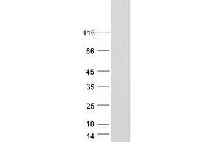 Validation with Western Blot