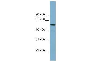 WB Suggested Anti-CDK5RAP1 Antibody Titration: 0. (CDK5RAP1 antibody  (N-Term))