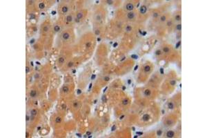 IHC-P analysis of liver tissue, with DAB staining. (PRKAB2 antibody  (AA 17-260))
