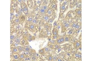 Immunohistochemistry of paraffin-embedded Mouse liver using CYP2C18 Polyclonal Antibody at dilution of 1:100 (40x lens). (CYP2C18 antibody)
