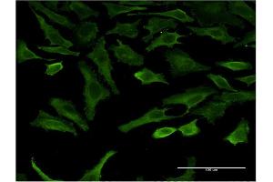 Immunofluorescence (IF) image for anti-serum/glucocorticoid Regulated Kinase 2 (SGK2) (AA 244-344) antibody (ABIN523487)