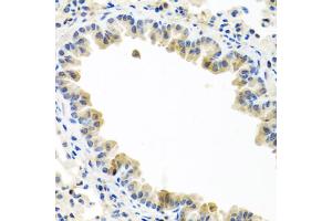 Immunohistochemistry of paraffin-embedded mouse lung using BMP5 antibody (ABIN5974675) at dilution of 1/100 (40x lens). (BMP5 antibody)