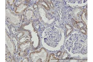 Image no. 5 for anti-Tumor Necrosis Factor Receptor Superfamily, Member 14 (TNFRSF14) (AA 38-283) antibody (ABIN563772)