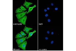 (ABIN570867) Immunofluorescence analysis of paraformaldehyde fixed A549 cells, permeabilized with 0. (IL1R2 antibody  (Internal Region))