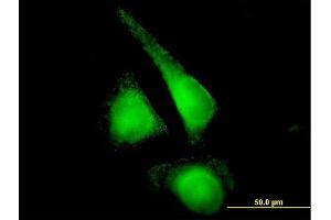 Immunofluorescence of purified MaxPab antibody to CYP2E1 on HeLa cell. (CYP2E1 antibody  (AA 1-493))