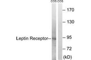 Western blot analysis of extracts from COS7 cells, treated with calyculinA 50ng/ml 30', using Leptin Receptor (Ab-1141) Antibody. (Leptin Receptor antibody  (AA 1107-1156))