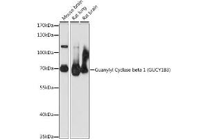 Western blot analysis of extracts of various cell lines, using Guanylyl Cyclase beta 1 (Guanylyl Cyclase beta 1 (GUCY1B3)) antibody (ABIN7267552) at 1:1000 dilution. (GUCY1B3 antibody  (AA 1-250))