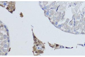 Immunohistochemistry of paraffin-embedded Rat testis using ESRRA Polyclonal Antibody at dilution of 1:200 (40x lens).