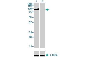 Western blot analysis of ZHX2 over-expressed 293 cell line, cotransfected with ZHX2 Validated Chimera RNAi (Lane 2) or non-transfected control (Lane 1). (ZHX2 antibody  (AA 691-788))