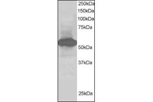 Antibody staining (1 µg/ml) of Human Kidney lysate (RIPA buffer, 30 µg total protein per lane). (SIL1 antibody  (C-Term))