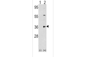 Western blot analysis of THPO using rabbit polyclonal THPO Antibody using 293 cell lysates (2 ug/lane) either nontransfected (Lane 1) or transiently transfected with the THPO gene (Lane 2). (Thrombopoietin antibody  (AA 243-273))