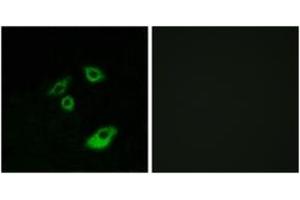 Immunofluorescence analysis of A549 cells, using BCL-2 (Phospho-Thr56) Antibody. (Bcl-2 antibody  (pThr56))