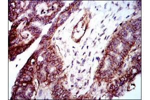 Immunohistochemistry (IHC) image for anti-Integrin beta 1 (ITGB1) antibody (ABIN969531)