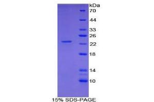 SDS-PAGE analysis of Human Shisa Homolog 4 Protein.