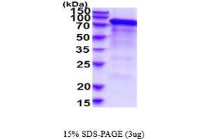 SDS-PAGE (SDS) image for Integrin beta 2 (ITGB2) (AA 23-700) protein (His tag) (ABIN5854581) (Integrin beta 2 Protein (ITGB2) (AA 23-700) (His tag))