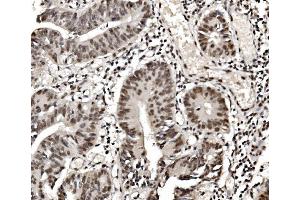 IHC analysis of hnRNP D/AUF1/HNRNPD using anti-hnRNP D/AUF1/HNRNPD antibody (ABIN7602591). (HNRNPD/AUF1 antibody  (AA 88-246))
