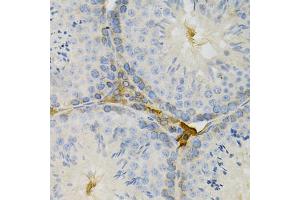 Immunohistochemistry of paraffin-embedded mouse testis using TAPBP Antibody (ABIN1875423) at dilution of 1:200 (40x lens). (TAPBP antibody)