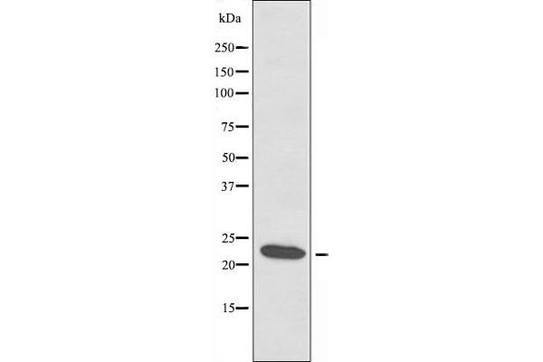 RPL18 antibody