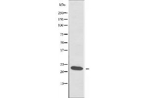 Western blot analysis of extracts from COLO cells using RPL18 antibody. (RPL18 antibody)