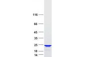 Western Blotting (WB) image for Regulator of G-Protein Signaling 10 (RGS10) (Transcript Variant 1) protein (Myc-DYKDDDDK Tag) (ABIN2730807)