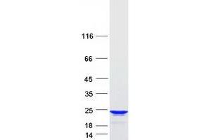 Validation with Western Blot (RGS10 Protein (Transcript Variant 1) (Myc-DYKDDDDK Tag))