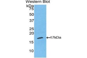 Western blot analysis of the recombinant protein. (TNFRSF19 antibody  (AA 222-363))