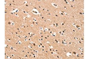 The image on the left is immunohistochemistry of paraffin-embedded Human brain tissue using ABIN7190422(CYP46A1 Antibody) at dilution 1/15, on the right is treated with synthetic peptide.