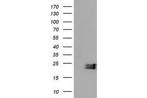 HEK293T cells were transfected with the pCMV6-ENTRY control (Left lane) or pCMV6-ENTRY EFNA2 (Right lane) cDNA for 48 hrs and lysed. (Ephrin A2 antibody)